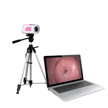 Цена портативного медицинского цифрового электронного кольпоскопа MY-F003A высокого разрешения для гинекологии
