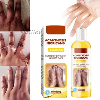 110 мл Отшелушивающего масла для тела Acanthosis Nigricans Peeling Oil Локти, руки, тело, Ровный тон кожи, Отбеливающий Уход за кожей